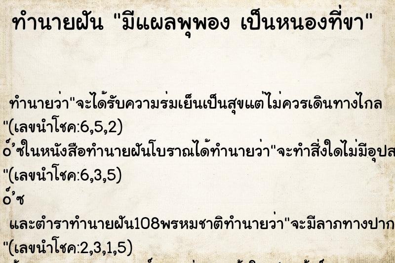 ทำนายฝัน มีแผลพุพอง เป็นหนองที่ขา